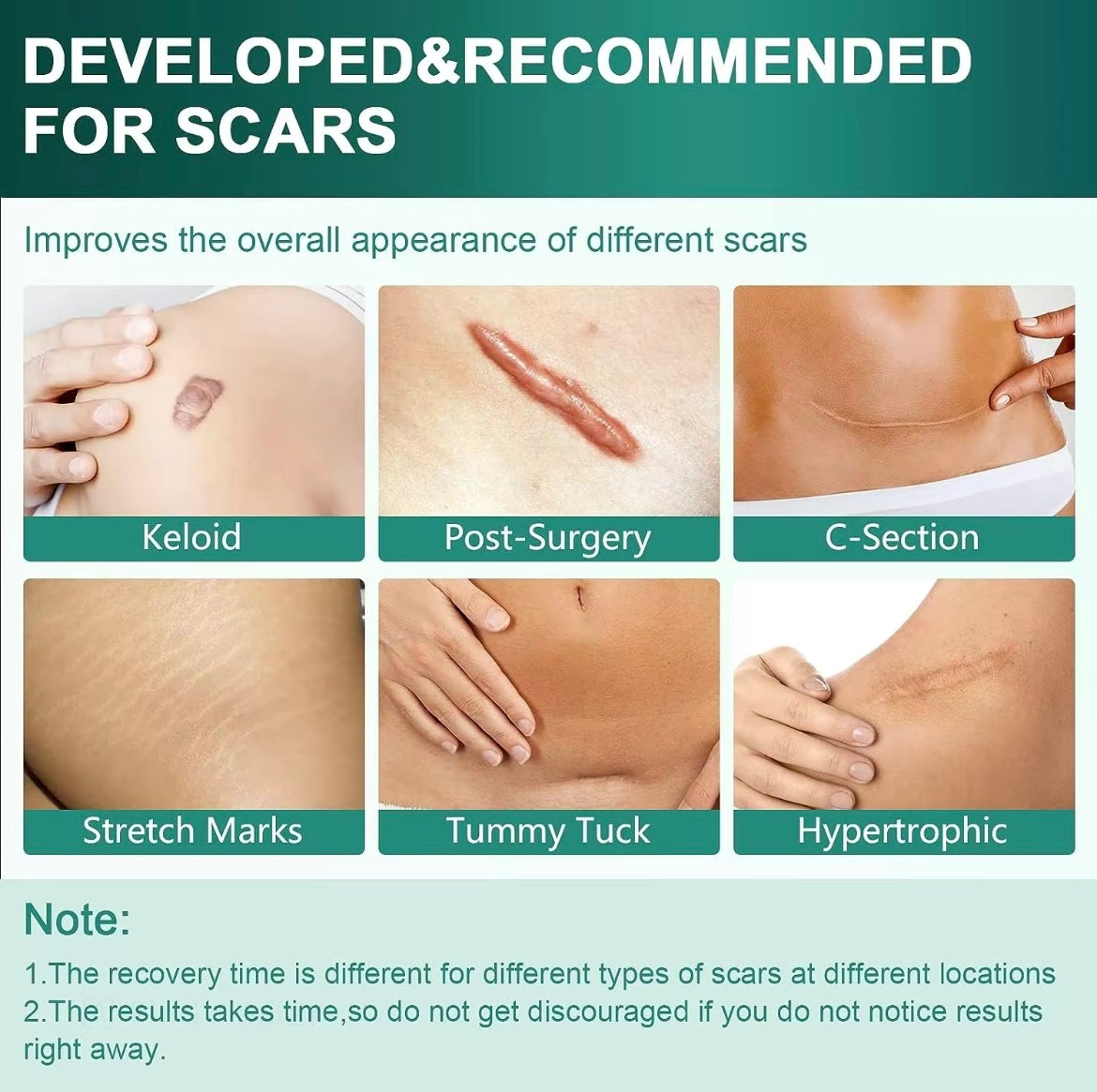 Naveo - Silicone Scar Tape